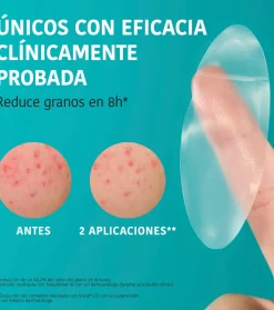 *Acne Prone Skin* - Parches para granos con ácido salicílico XL