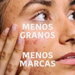 *Acne Prone Skin* - Sérum facial Prevent & Correct - Pieles acnéicas