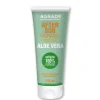 After sun aloe vera