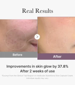 *Age-R* - Crema iluminadora Glutathione Glow Capsule
