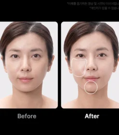 *Age-R* - Dispositivo avanzado de cuidado facial Booster Pro Ex - Pink