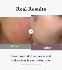 *Age-R* - Tónico hidratante Glutathione Glow Toner