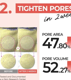 Almohadillas con tónico No. 4 Pore Zero Peeled Egg