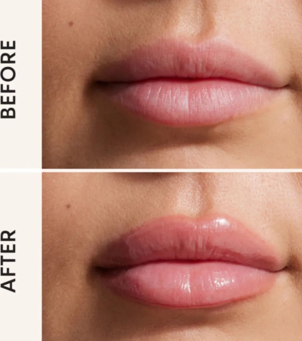 Brillo de labios voluminizador Lip Filler - 001: Baby
