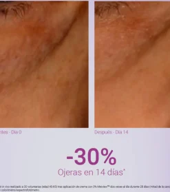 Contorno de ojos antiarrugas Xpert Expression Contour