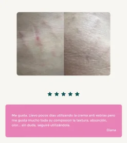 Crema anti-estrías con Sangre de Dragón