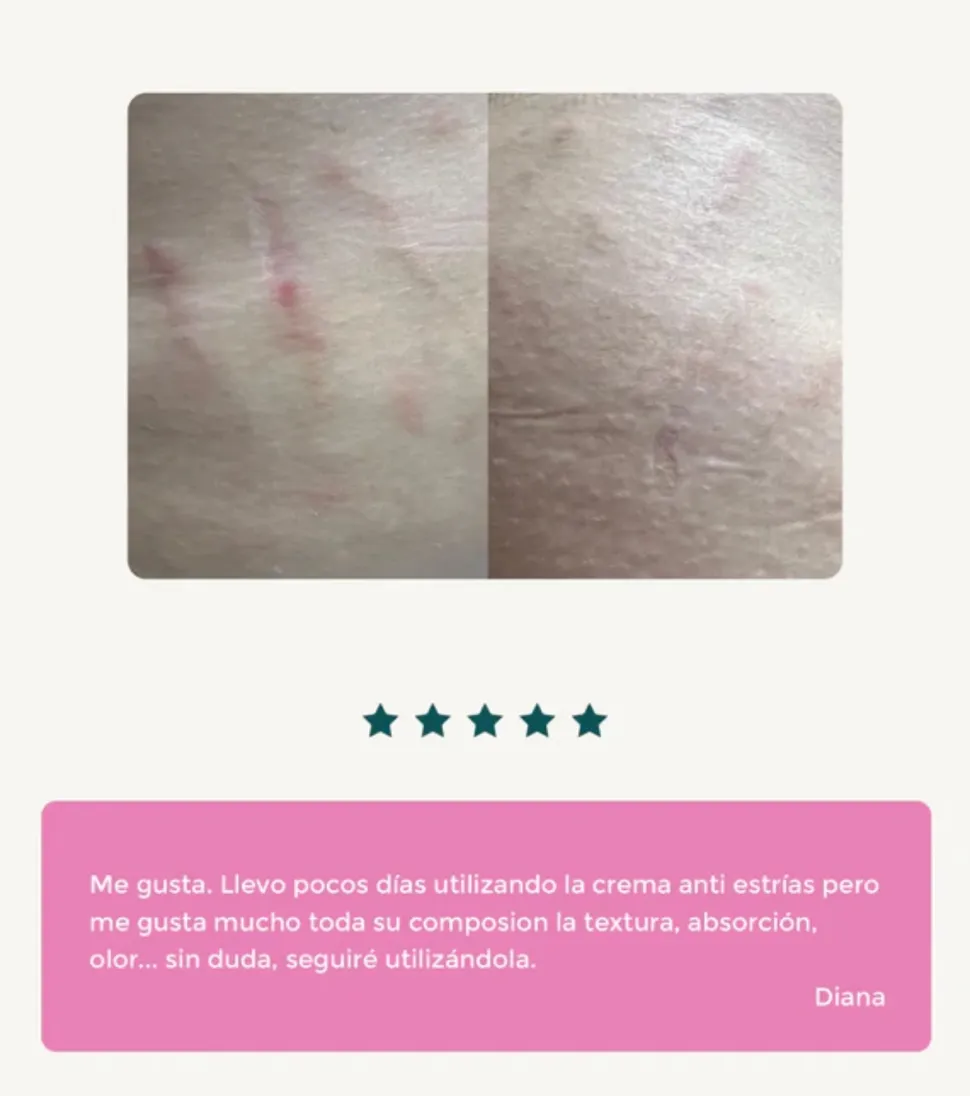 Crema anti-estrías con Sangre de Dragón
