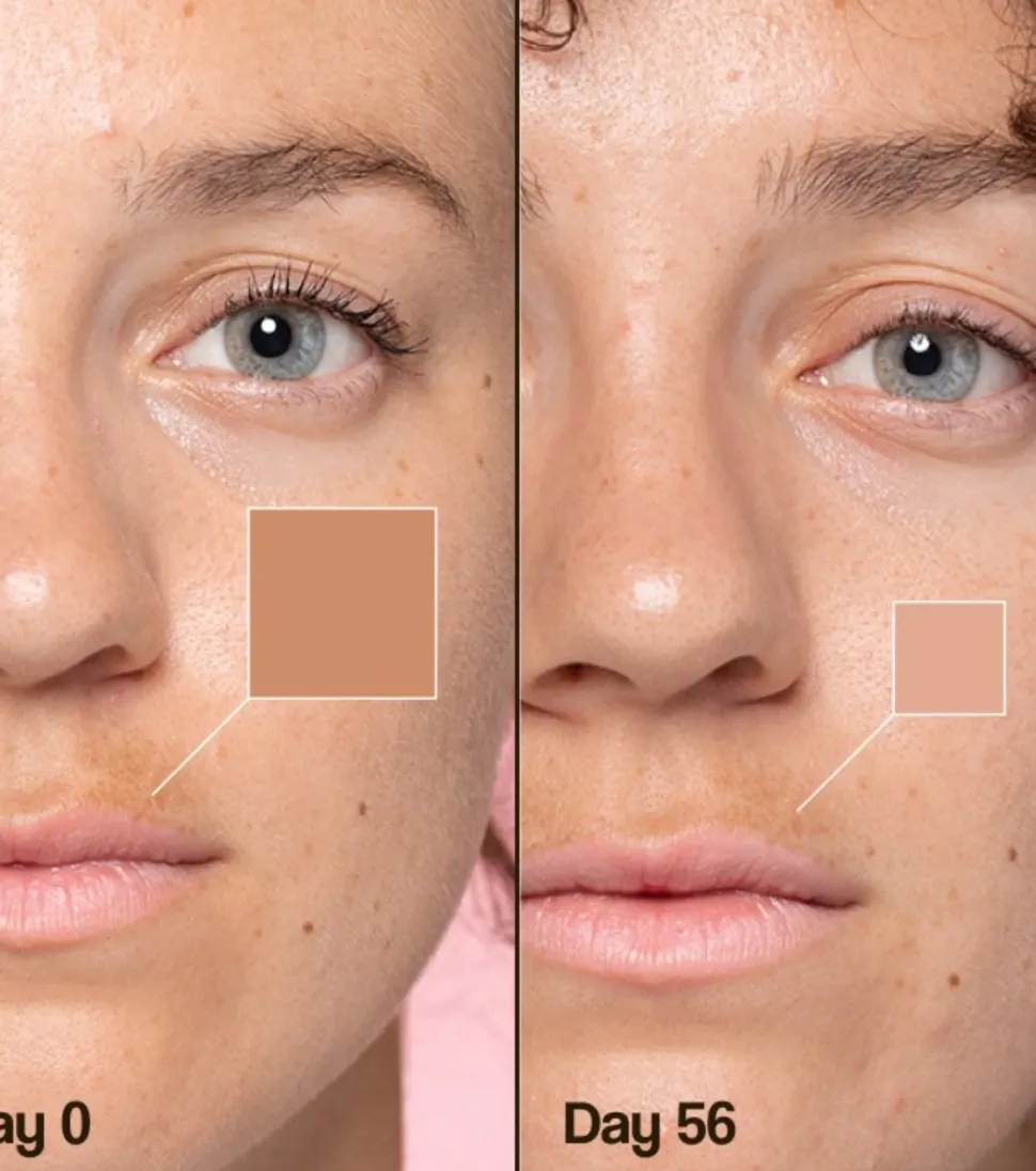 Crema facial despigmentante Lotus Radiance Dark Spot Treatment