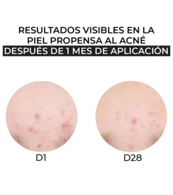 Crema hidratante pieles mixtas y grasas