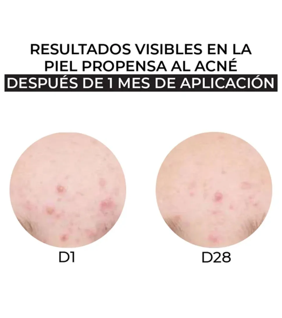 Crema hidratante pieles mixtas y grasas