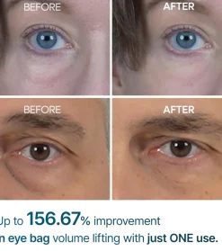 Crema para las ojeras Eyephalt