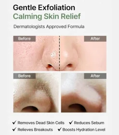 *Ji Woo Gae* - Almohadillas exfoliantes Heartleaf BHA