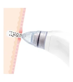 Limpiador facial eléctrico para puntos negros Pore·Off