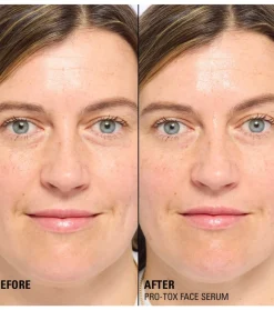 *Miracle Pro-Tox* - Sérum facial reparador y rellenador de líneas