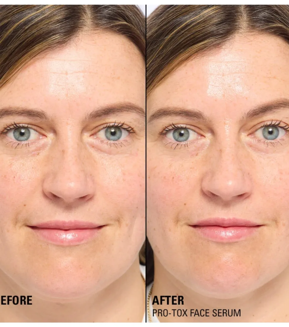 *Miracle Pro-Tox* - Sérum facial reparador y rellenador de líneas