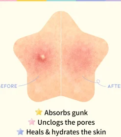 Parches para granos en forma de estrella Star Spot Patch