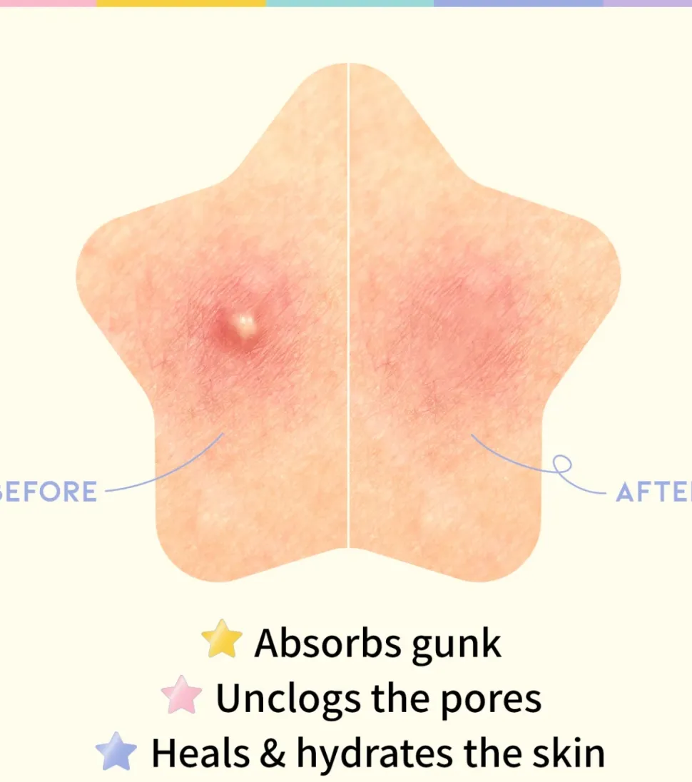 Parches para granos en forma de estrella Star Spot Patch