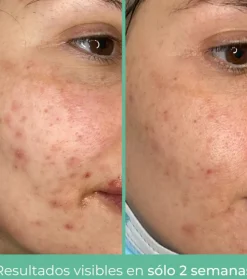 *Purifying* - Crema facial seborreguladora