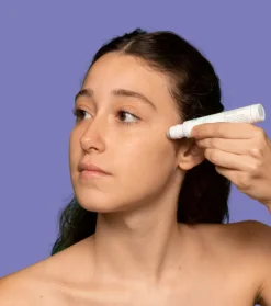 *Refine* - Roll on Spot & Acne