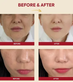 *Seoul 1988* - Esencia Snail Mucin 97% + Rice