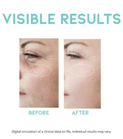 Sérum antiarrugas retinol Wrinkle Lift