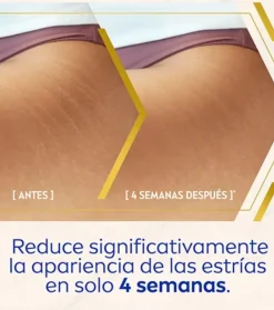 Sérum corporal anti-estrías y anti-manchas tratamiento avanzado Luminous 630