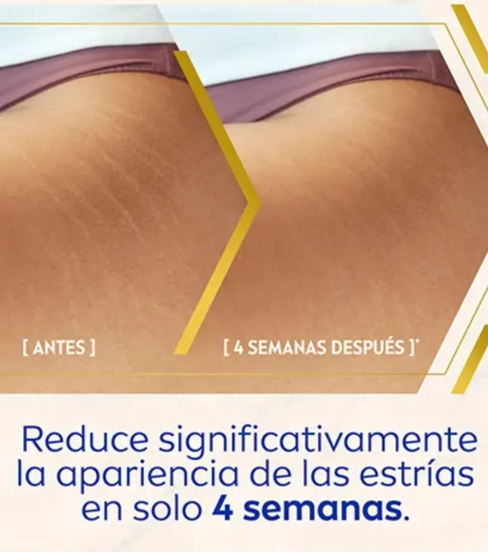 Sérum corporal anti-estrías y anti-manchas tratamiento avanzado Luminous 630