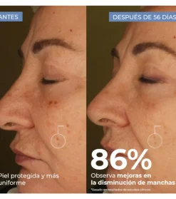 Sérum facial despigmentante Porcelain