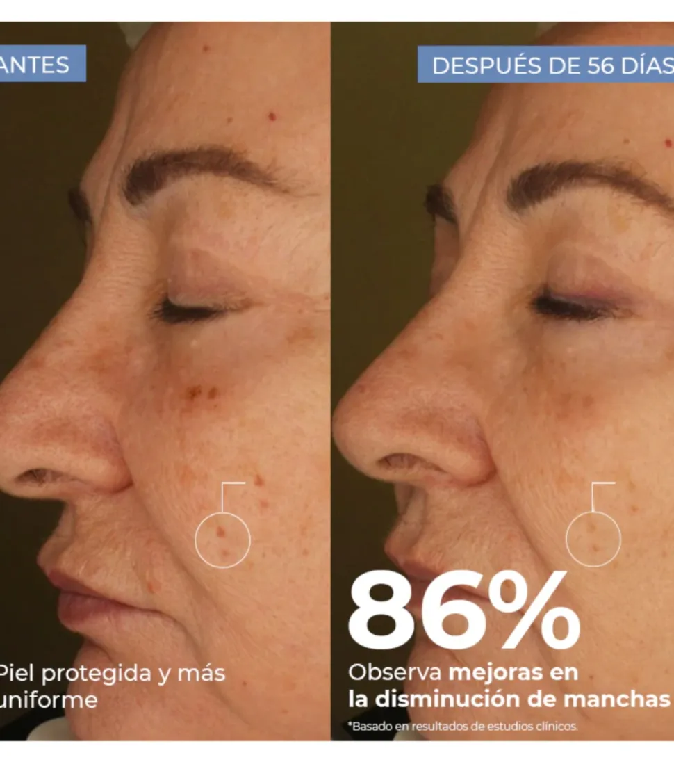 Sérum facial despigmentante Porcelain