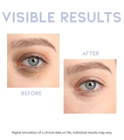 Sérum para el contorno de los ojos revitalizante Intensive Serum
