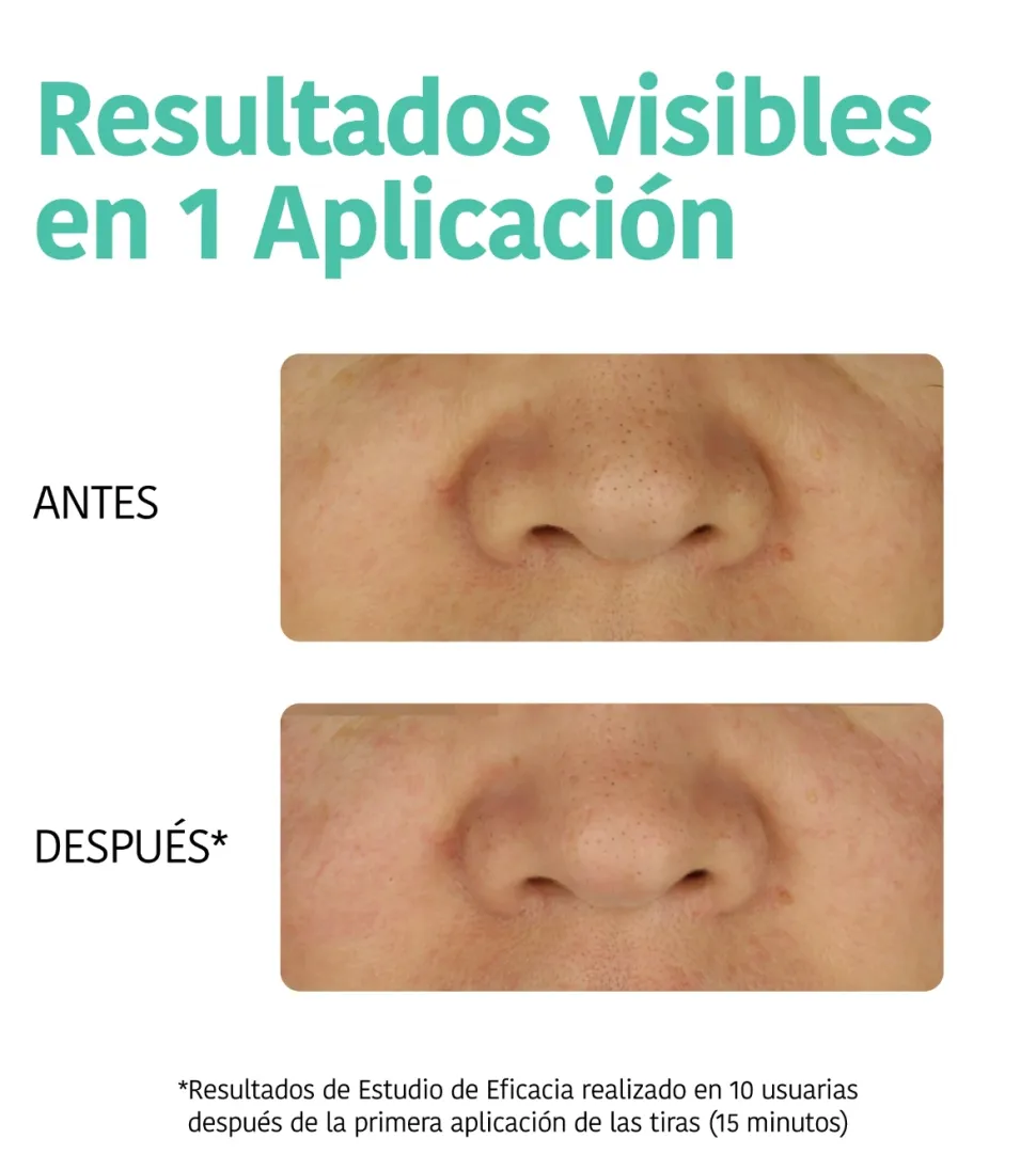 Tiras Detox Anti Puntos Negros - Carbón