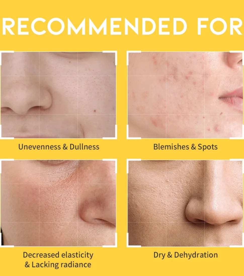 Tónico iluminador Dark Spot Vitamin C