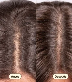 Tratamiento anticaída para el cabello Hair Growth & Density