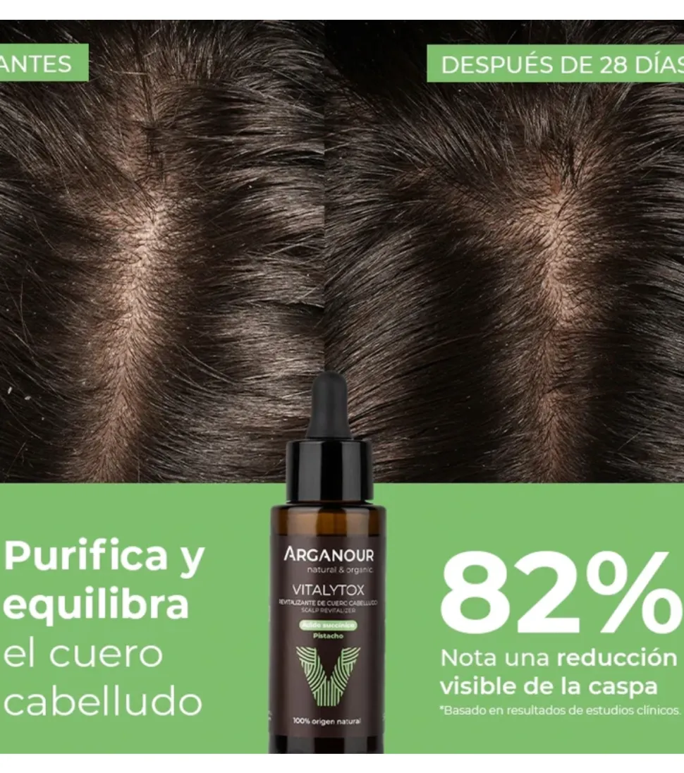 Tratamiento revitalizante de cuero cabelludo Vitalytox