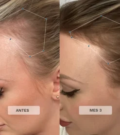 Vitaminas para el cabello Advance + Premium