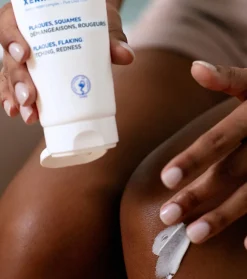 *Xerial* - Crema para tratar los síntomas de la psoriasis