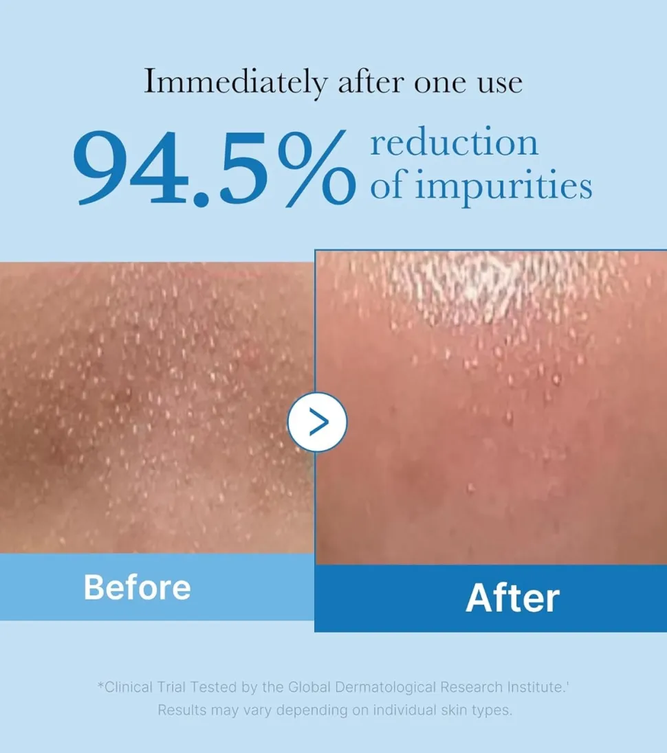 *Zero Pore* - Aceite limpiador Blackhead Deep