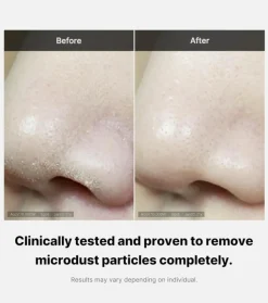 *Zero Pore* - Limpiador facial en espuma